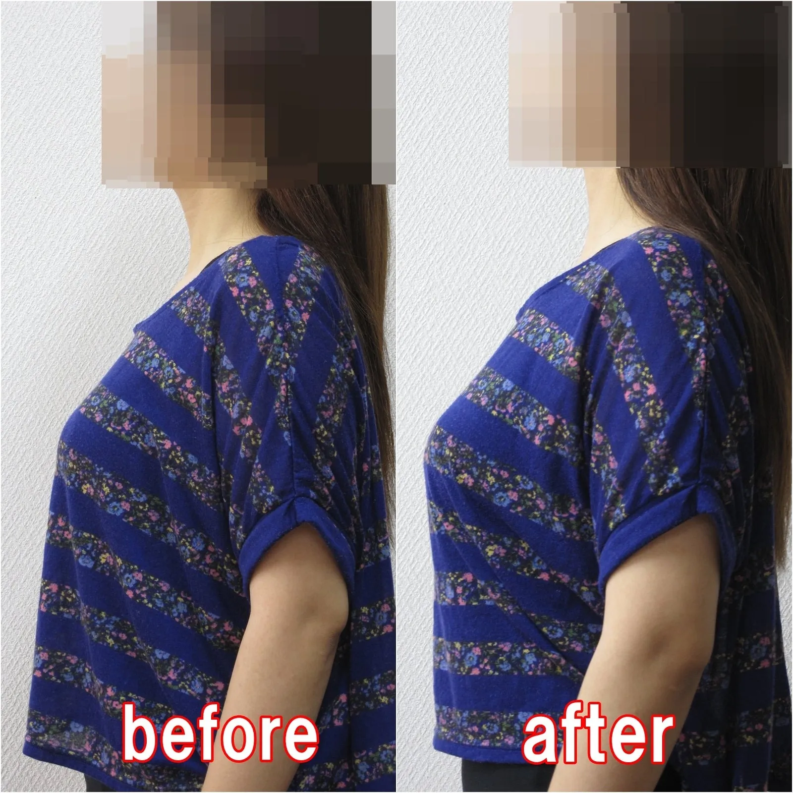 ビフォーアフター